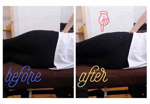 骨盤矯正ビフォーアフター